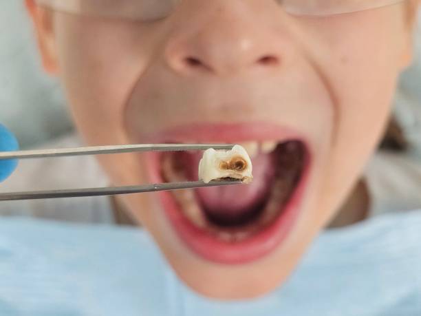 Emergency Dentist for Kids in AR